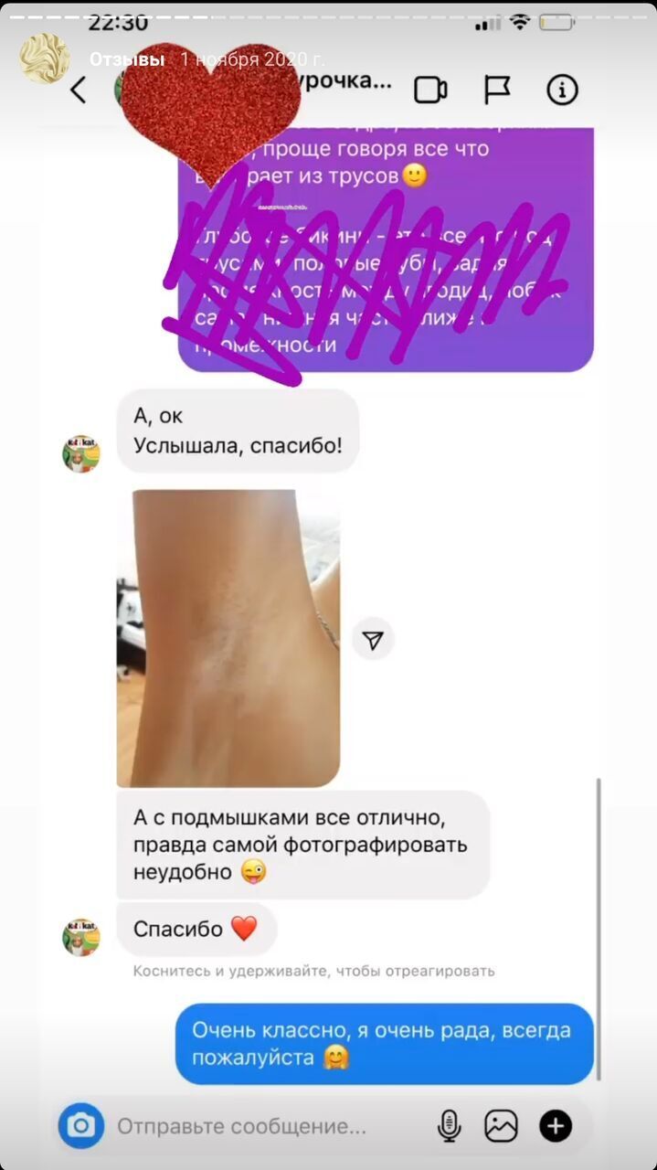 Отзыв Эпилток♥